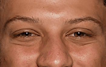 Patrick Mahomes eye color