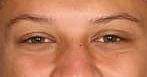 Patrick Mahomes eye color