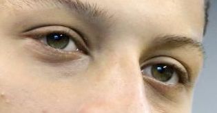 Patrick Mahomes eye color