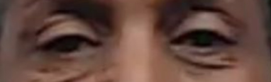 Patrick Mahomes eye color