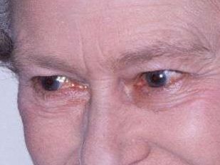 Queen Elizabeth eye color