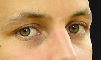 Steph Curry eye color