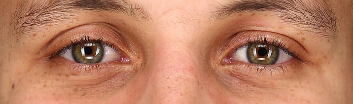 Steph Curry eye color