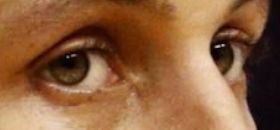 Steph Curry eye color