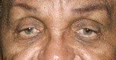 Joe Jackson eye color