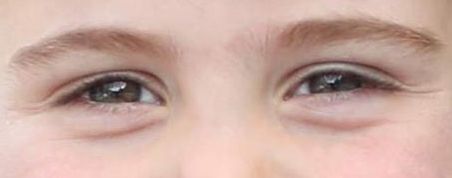 Prince Louis eye color