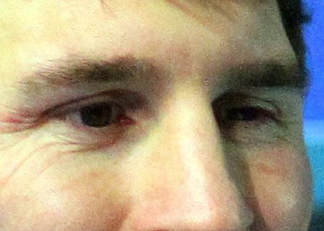 Messi eye color