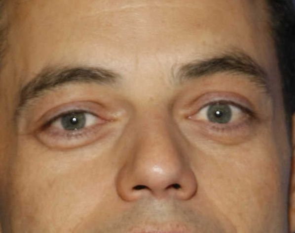 Rami Malek eye color