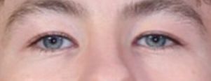 Barry Keoghan eye color