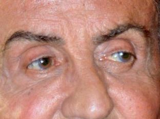 Sylvester Stallone eye color