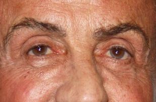 Sylvester Stallone eye color