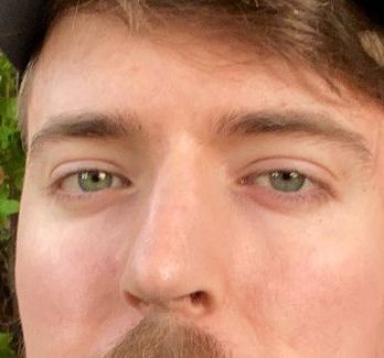 Mr Beast eye color