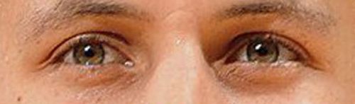 Stephen Curry eye color