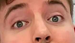 Mr Beast eye color