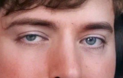 Mr Beast eye color