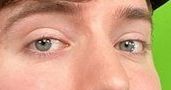 Mr Beast eye color