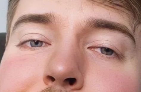 Mr Beast eye color