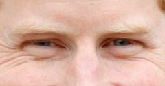 Prince Harry eye color