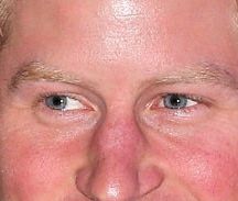 Prince Harry eye color