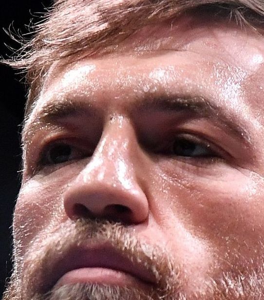 Conor Mcgregor eye color