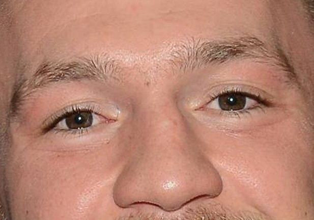 Conor Mcgregor eye color