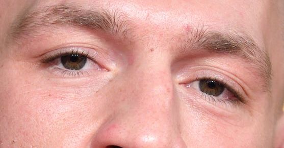 Conor Mcgregor eye color