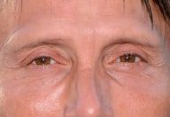 Mads Mikkelsen eye color