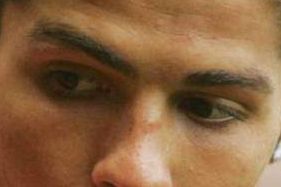 Ronaldo eye color