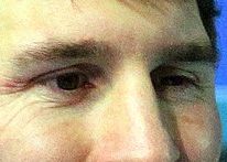 Lionel Messi eye color