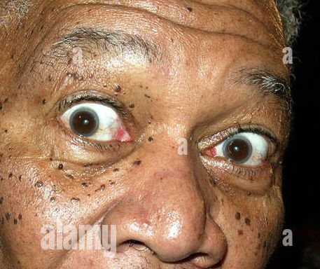 Morgan Freeman eye color