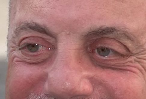 Billy Joel eye color