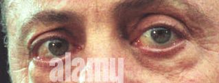 Billy Joel eye color