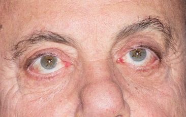 Billy Joel eye color