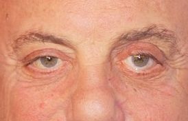 Billy Joel eye color