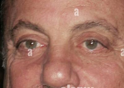 Billy Joel eye color