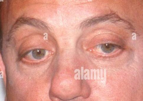 Billy Joel eye color