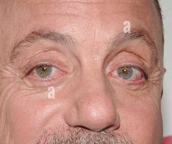 Billy Joel eye color