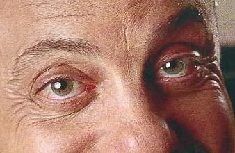 Billy Joel eye color