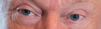 Trump eye color