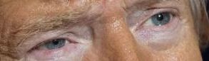 Trump eye color