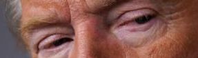 Trump eye color