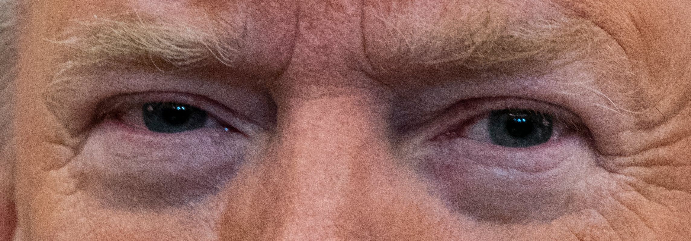 Trump eye color