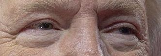 Trump eye color