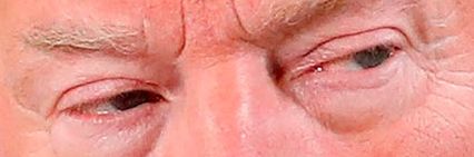 Trump eye color