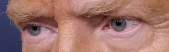 Trump eye color