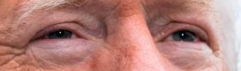 Trump eye color