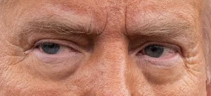 Trump eye color